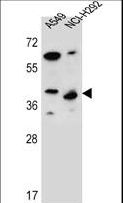 PPP1R42 / LRRC67 Antibody - LRRC67 Antibody western blot of A549,NCI-H292 cell line lysates (35 ug/lane). The LRRC67 antibody detected the LRRC67 protein (arrow).