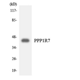 PPP1R7 Antibody - Western blot analysis of the lysates from 293 cells using PPP1R7 antibody.