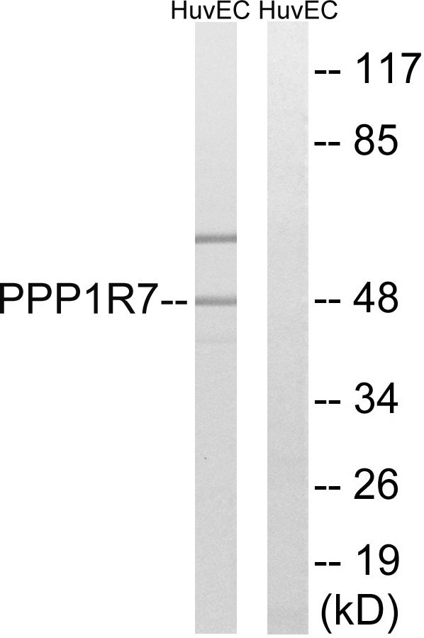 PPP1R7 Antibody - Western blot analysis of lysates from HUVEC cells, using PPP1R7 Antibody. The lane on the right is blocked with the synthesized peptide.