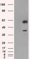 PPP1R7 Antibody - HEK293T cells were transfected with the pCMV6-ENTRY control (Left lane) or pCMV6-ENTRY PPP1R7 (Right lane) cDNA for 48 hrs and lysed. Equivalent amounts of cell lysates (5 ug per lane) were separated by SDS-PAGE and immunoblotted with anti-PPP1R7.