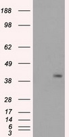 PPP1R7 Antibody - HEK293T cells were transfected with the pCMV6-ENTRY control (Left lane) or pCMV6-ENTRY PPP1R7 (Right lane) cDNA for 48 hrs and lysed. Equivalent amounts of cell lysates (5 ug per lane) were separated by SDS-PAGE and immunoblotted with anti-PPP1R7.