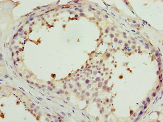 PPP1R7 Antibody - Immunohistochemistry of paraffin-embedded human testis tissue using PPP1R7 Antibody at dilution of 1:100