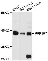 PPP1R7 Antibody - Western blot analysis of extracts of various cell lines, using PPP1R7 antibody at 1:3000 dilution. The secondary antibody used was an HRP Goat Anti-Rabbit IgG (H+L) at 1:10000 dilution. Lysates were loaded 25ug per lane and 3% nonfat dry milk in TBST was used for blocking. An ECL Kit was used for detection and the exposure time was 90s.