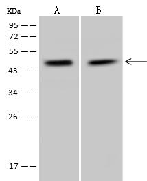 PPP1R7 Antibody - Anti-PPP1R7 rabbit polyclonal antibody at 1:500 dilution. Lane A: RT-4 Whole Cell Lysate. Lane B: U-251 MG Whole Cell Lysate. Lysates/proteins at 30 ug per lane. Secondary: Goat Anti-Rabbit IgG (H+L)/HRP at 1/10000 dilution. Developed using the ECL technique. Performed under reducing conditions. Predicted band size: 42 kDa. Observed band size: 45 kDa.