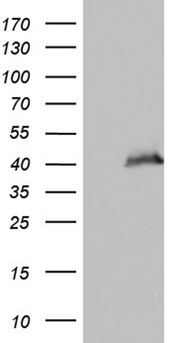 PPP1R8 / Rnase E Antibody - HEK293T cells were transfected with the pCMV6-ENTRY control. (Left lane) or pCMV6-ENTRY PPP1R8. (Right lane) cDNA for 48 hrs and lysed. Equivalent amounts of cell lysates. (5 ug per lane) were separated by SDS-PAGE and immunoblotted with anti-PPP1R8.