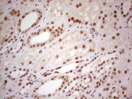 PPP1R8 / Rnase E Antibody - Immunohistochemical staining of paraffin-embedded Human Kidney tissue within the normal limits using anti-PPP1R8 mouse monoclonal antibody. (Heat-induced epitope retrieval by 1 mM EDTA in 10mM Tris, pH8.5, 120C for 3min,