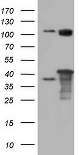 PPP1R8 / Rnase E Antibody - HEK293T cells were transfected with the pCMV6-ENTRY control. (Left lane) or pCMV6-ENTRY PPP1R8. (Right lane) cDNA for 48 hrs and lysed. Equivalent amounts of cell lysates. (5 ug per lane) were separated by SDS-PAGE and immunoblotted with anti-PPP1R8.