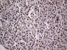 PPP1R8 / Rnase E Antibody - Immunohistochemical staining of paraffin-embedded Human pancreas tissue within the normal limits using anti-PPP1R8 mouse monoclonal antibody. (Heat-induced epitope retrieval by 1 mM EDTA in 10mM Tris, pH8.5, 120C for 3min,