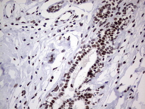 PPP1R8 / Rnase E Antibody - Immunohistochemical staining of paraffin-embedded Human breast tissue within the normal limits using anti-PPP1R8 mouse monoclonal antibody. (Heat-induced epitope retrieval by 1 mM EDTA in 10mM Tris, pH8.5, 120C for 3min,