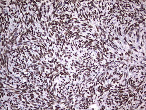 PPP1R8 / Rnase E Antibody - Immunohistochemical staining of paraffin-embedded Human Ovary tissue within the normal limits using anti-PPP1R8 mouse monoclonal antibody. (Heat-induced epitope retrieval by 1 mM EDTA in 10mM Tris, pH8.5, 120C for 3min,