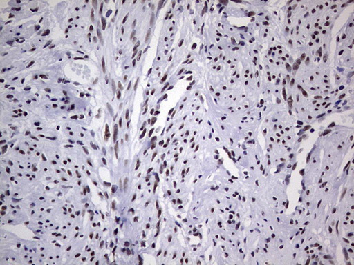 PPP1R8 / Rnase E Antibody - Immunohistochemical staining of paraffin-embedded Human endometrium tissue within the normal limits using anti-PPP1R8 mouse monoclonal antibody. (Heat-induced epitope retrieval by 1 mM EDTA in 10mM Tris, pH8.5, 120C for 3min,