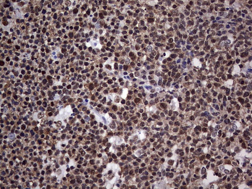 PPP1R8 / Rnase E Antibody - Immunohistochemical staining of paraffin-embedded Human tonsil within the normal limits using anti-PPP1R8 mouse monoclonal antibody. (Heat-induced epitope retrieval by 1 mM EDTA in 10mM Tris, pH8.5, 120C for 3min,