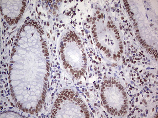 PPP1R8 / Rnase E Antibody - Immunohistochemical staining of paraffin-embedded Human colon tissue within the normal limits using anti-PPP1R8 mouse monoclonal antibody. (Heat-induced epitope retrieval by 1 mM EDTA in 10mM Tris, pH8.5, 120C for 3min,