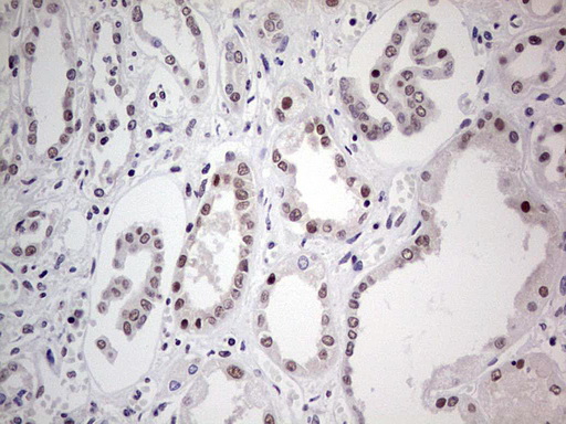 PPP1R8 / Rnase E Antibody - Immunohistochemical staining of paraffin-embedded Human Kidney tissue within the normal limits using anti-PPP1R8 mouse monoclonal antibody. (Heat-induced epitope retrieval by 1 mM EDTA in 10mM Tris, pH8.5, 120C for 3min,