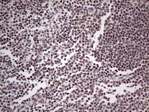 PPP1R8 / Rnase E Antibody - IHC of paraffin-embedded Human tonsil using anti-PPP1R8 mouse monoclonal antibody. (Heat-induced epitope retrieval by 1 mM EDTA in 10mM Tris, pH8.5, 120°C for 3min).