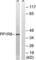 PPP1R8 / Rnase E Antibody - Western blot analysis of lysates from Jurkat cells, using PPP1R8 Antibody. The lane on the right is blocked with the synthesized peptide.