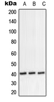 PPP1R8 / Rnase E Antibody - Western blot analysis of ARD1 expression in HeLa (A); SP2/0 (B); H9C2 (C) whole cell lysates.