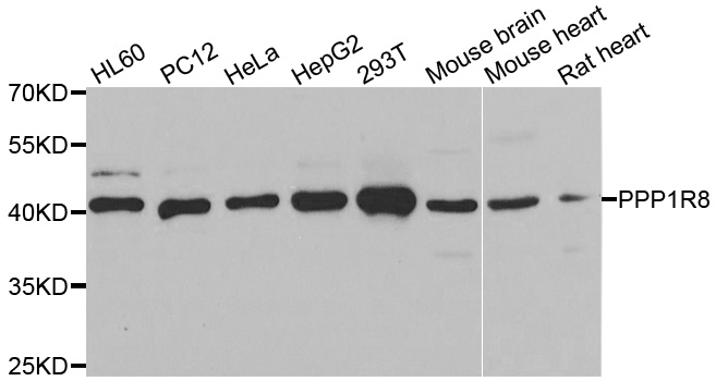 PPP1R8 / Rnase E Antibody - Western blot analysis of extracts of various cell lines.