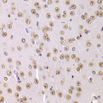 PPP1R8 / Rnase E Antibody - Immunohistochemistry of paraffin-embedded Mouse brain tissue.