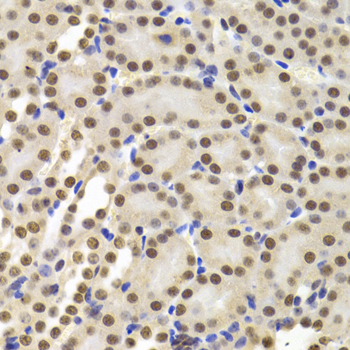 PPP1R8 / Rnase E Antibody - Immunohistochemistry of paraffin-embedded Mouse kidney tissue.