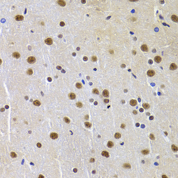 PPP1R8 / Rnase E Antibody - Immunohistochemistry of paraffin-embedded Rat brain tissue.