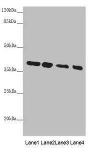PPP1R8 / Rnase E Antibody - Western blot All Lanes: PPP1R8 antibody at 4.73 ug/ml Lane 1: PC-3 whole cell lysate Lane 2: HL60 whole cell lysate Lane 3: HepG-2 whole cell lysate Lane 4: Hela whole cell lysate Secondary Goat polyclonal to rabbit IgG at 1/10000 dilution Predicted band size: 39,23,14 kDa Observed band size: 38 kDa