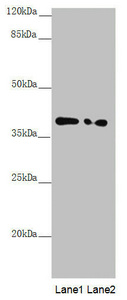 PPP1R8 / Rnase E Antibody - Western blot All Lanes: PPP1R8 antibody at 1.11 ug/ml Lane 1: PC-3 whole cell lysate Lane 2: HL60 whole cell lysate Secondary Goat polyclonal to rabbit IgG at 1/10000 dilution Predicted band size: 39,23,14 kDa Observed band size: 38 kDa
