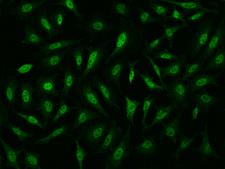 PPP1R8 / Rnase E Antibody - Immunofluorescence staining of PPP1R8 in HeLa cells. Cells were fixed with 4% PFA, permeabilzed with 0.1% Triton X-100 in PBS, blocked with 10% serum, and incubated with rabbit anti-Human PPP1R8 polyclonal antibody (dilution ratio 1:1000) at 4°C overnight. Then cells were stained with the Alexa Fluor 488-conjugated Goat Anti-rabbit IgG secondary antibody (green). Positive staining was localized to Nucleus.