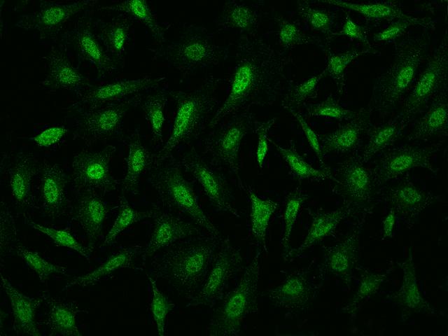 PPP1R8 / Rnase E Antibody - Immunofluorescence staining of PPP1R8 in HeLa cells. Cells were fixed with 4% PFA, permeabilzed with 0.1% Triton X-100 in PBS, blocked with 10% serum, and incubated with rabbit anti-Human PPP1R8 polyclonal antibody (dilution ratio 1:1000) at 4°C overnight. Then cells were stained with the Alexa Fluor 488-conjugated Goat Anti-rabbit IgG secondary antibody (green). Positive staining was localized to Nucleus.
