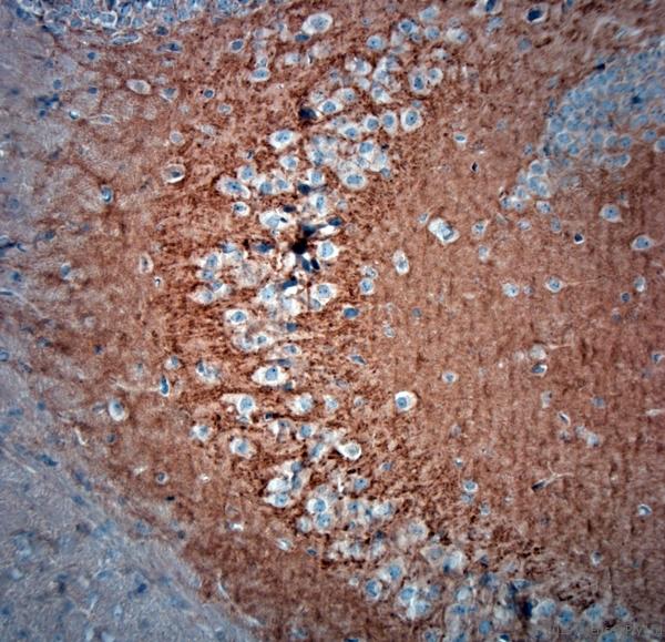 PPP1R9B / Spinophilin Antibody - IHC-P on paraffin sections of mouse brain. The animal was perfused using Autoperfuser at a pressure of 130 mmHg with 300 ml 4% FA before being processed for paraffin embedding. HIER: Tris-EDTA, pH 9 for 20 min using Thermo PT Module. Blocking: 0.2% LFDM in TBST filtered through 0.2 µm. Detection was done using Novolink HRP polymer from Leica following manufacturers instructions; DAB chromogen: Candela DAB chromogen. Primary antibody: dilution 1:1000, incubated 30 min at RT using Autostainer. Sections were counterstained with Harris Hematoxylin. Small neurons are stained and also some nuclear staining is observed.