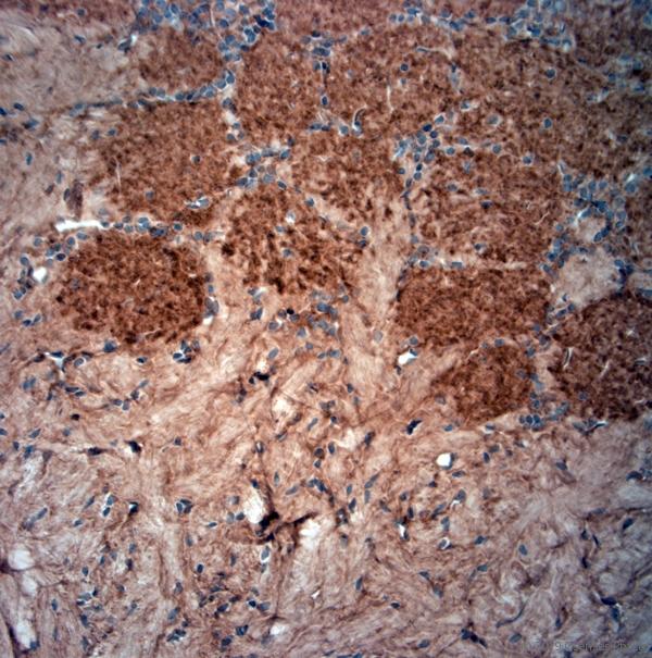PPP1R9B / Spinophilin Antibody - IHC-P on paraffin sections of rat olfactory bulbs. The animal was perfused using Autoperfuser at a pressure of 130 mmHg with 300 ml 4% FA before being processed for paraffin embedding. HIER: Tris-EDTA, pH 9 for 20 min using Thermo PT Module. Blocking: 0.2% LFDM in TBST filtered through 0.2 µm. Detection was done using Novolink HRP polymer from Leica following manufacturers instructions; DAB chromogen: Candela DAB chromogen. Primary antibody: dilution 1:1000, incubated 30 min at RT using Autostainer. Sections were counterstained with Harris Hematoxylin. Small neurons are stained and also some nuclear staining is observed.
