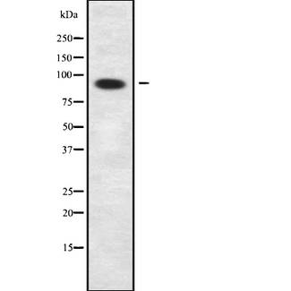 PPP1R9B / Spinophilin Antibody - Western blot analysis NEB2 using 293 whole cells lysates
