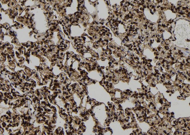 PPP1R9B / Spinophilin Antibody - 1:100 staining rat lung tissue by IHC-P. The sample was formaldehyde fixed and a heat mediated antigen retrieval step in citrate buffer was performed. The sample was then blocked and incubated with the antibody for 1.5 hours at 22°C. An HRP conjugated goat anti-rabbit antibody was used as the secondary.