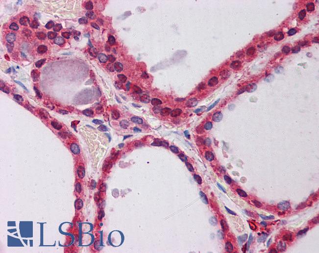 PPP2R1A Antibody - Anti-PPP2R1A antibody IHC of human thyroid. Immunohistochemistry of formalin-fixed, paraffin-embedded tissue after heat-induced antigen retrieval. Antibody concentration 5 ug/ml.  This image was taken for the unconjugated form of this product. Other forms have not been tested.