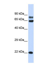 PPP2R1A Antibody - PPP2R1A antibody Western blot of 293T cell lysate. This image was taken for the unconjugated form of this product. Other forms have not been tested.