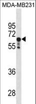PPP2R1A Antibody - PPP2R1A Antibody western blot of MDA-MB231 cell line lysates (35 ug/lane). The PPP2R1A antibody detected the PPP2R1A protein (arrow).