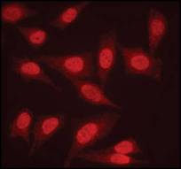 PPP2R1A Antibody - Immunofluorescent staining of paraformaldehyde fixed HeLa cells