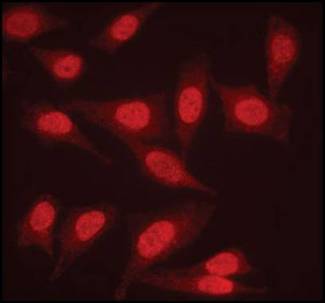 PPP2R1A Antibody - Immunofluorescent staining of paraformaldehyde fixed HeLa cells