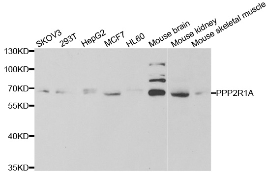 PPP2R1A Antibody - Western blot analysis of extracts of various cell lines.