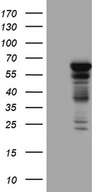 PPP2R1B Antibody - HEK293T cells were transfected with the pCMV6-ENTRY control. (Left lane) or pCMV6-ENTRY PPP2R1B. (Right lane) cDNA for 48 hrs and lysed. Equivalent amounts of cell lysates. (5 ug per lane) were separated by SDS-PAGE and immunoblotted with anti-PPP2R1B. (1:2000)