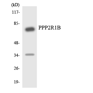 PPP2R1B Antibody - Western blot analysis of the lysates from Jurkat cells using PPP2R1B antibody.