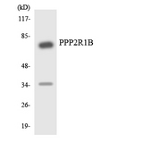 PPP2R1B Antibody - Western blot analysis of the lysates from Jurkat cells using PPP2R1B antibody.