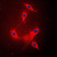 PPP2R1B Antibody - Immunofluorescent analysis of PPP2R1B staining in Raw264.7 cells. Formalin-fixed cells were permeabilized with 0.1% Triton X-100 in TBS for 5-10 minutes and blocked with 3% BSA-PBS for 30 minutes at room temperature. Cells were probed with the primary antibody in 3% BSA-PBS and incubated overnight at 4 C in a humidified chamber. Cells were washed with PBST and incubated with a DyLight 594-conjugated secondary antibody (red) in PBS at room temperature in the dark. DAPI was used to stain the cell nuclei (blue).