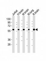 PPP2R1B Antibody - All lanes : Anti-PPP2R1B Antibody at 1:4000 dilution Lane 1: Jurkat whole cell lysates Lane 2: human brain lysates Lane 3: mouse brain lysates Lane 4: mouse lung lysates Lane 5: rat brain lysates Lysates/proteins at 20 ug per lane. Secondary Goat Anti-Rabbit IgG, (H+L), Peroxidase conjugated at 1/10000 dilution Predicted band size : 66 kDa Blocking/Dilution buffer: 5% NFDM/TBST.