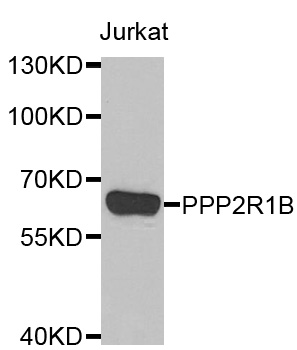 PPP2R1B Antibody - Western blot analysis of extracts of Jurkat cells.