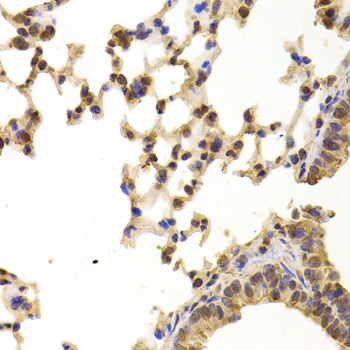 PPP2R1B Antibody - Immunohistochemistry of paraffin-embedded Mouse lung tissue.