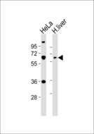 PPP2R1B Antibody - All lanes : Anti-PPP2R1B Antibody at 1:1000 dilution Lane 1: HeLa whole cell lysates Lane 2: human liver lysates Lysates/proteins at 20 ug per lane. Secondary Goat Anti-Rabbit IgG, (H+L),Peroxidase conjugated at 1/10000 dilution Predicted band size : 66 kDa Blocking/Dilution buffer: 5% NFDM/TBST.