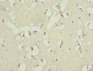 PPP2R1B Antibody - Immunohistochemistry of paraffin-embedded human brain tissue at dilution 1:100