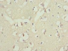 PPP2R1B Antibody - Immunohistochemistry of paraffin-embedded human brain tissue at dilution 1:100