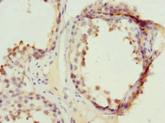 PPP2R1B Antibody - Immunohistochemistry of paraffin-embedded human testis tissue at dilution 1:100